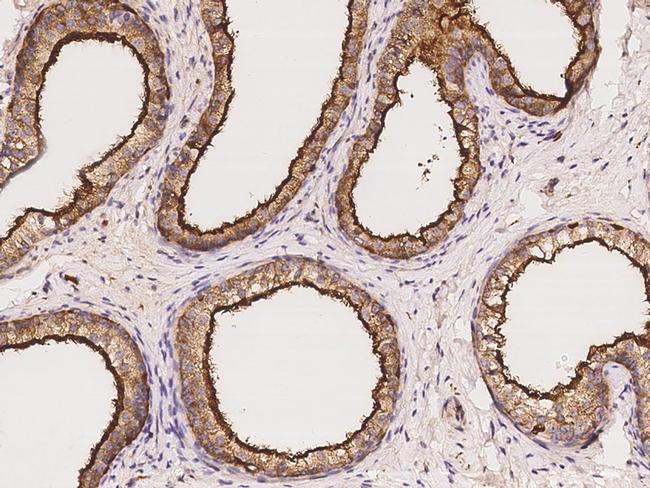 EBP50 Antibody in Immunohistochemistry (Paraffin) (IHC (P))