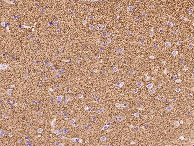 SYNGR1 Antibody in Immunohistochemistry (Paraffin) (IHC (P))