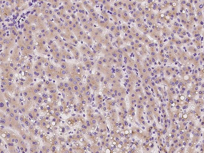 TMED2 Antibody in Immunohistochemistry (Paraffin) (IHC (P))