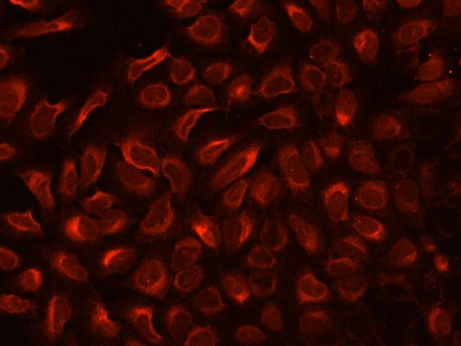 TXNDC5 Antibody in Immunocytochemistry (ICC/IF)