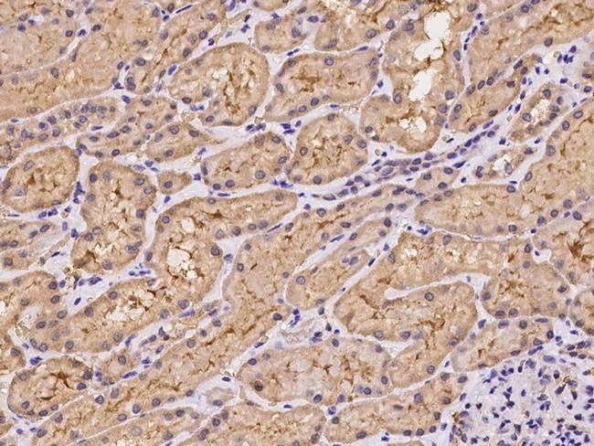 UEVLD Antibody in Immunohistochemistry (Paraffin) (IHC (P))