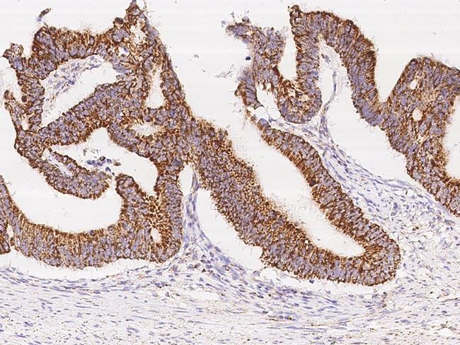 UQCRB Antibody in Immunohistochemistry (Paraffin) (IHC (P))