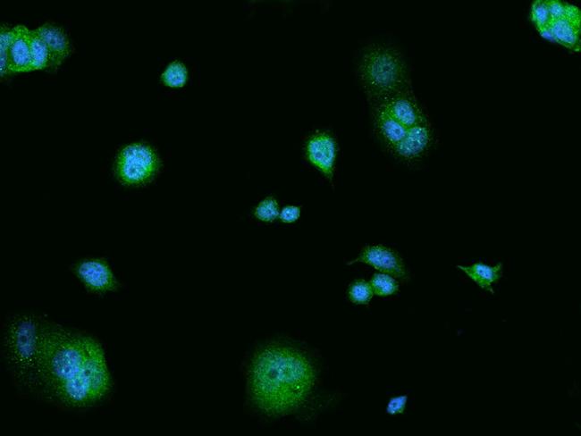 VAV2 Antibody in Immunocytochemistry (ICC/IF)