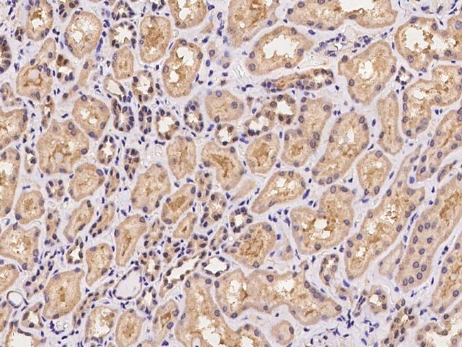 VPS25 Antibody in Immunohistochemistry (Paraffin) (IHC (P))