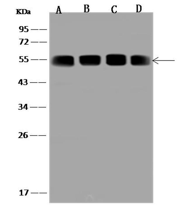 XIAP Antibody in Western Blot (WB)