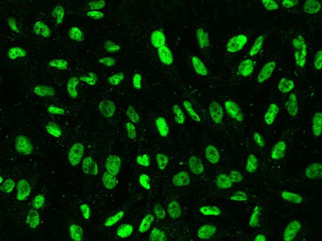 XRCC1 Antibody in Immunocytochemistry (ICC/IF)