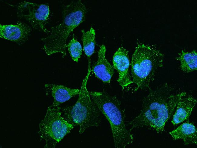 YES1 Antibody in Immunocytochemistry (ICC/IF)