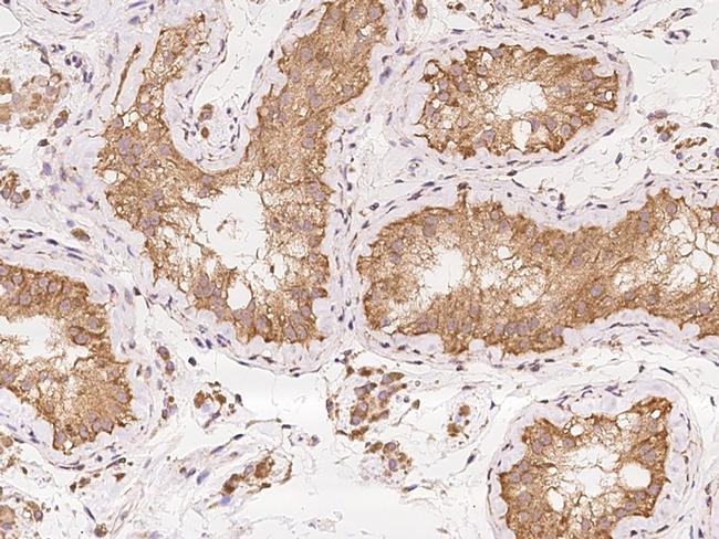 ZMAT1 Antibody in Immunohistochemistry (Paraffin) (IHC (P))