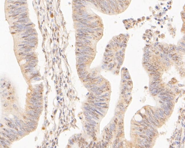 CPEB1 Antibody in Immunohistochemistry (Paraffin) (IHC (P))