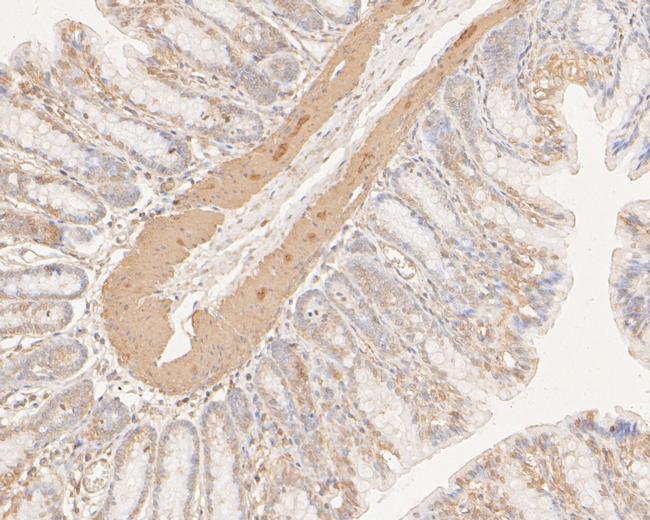 DNA2 Antibody in Immunohistochemistry (Paraffin) (IHC (P))