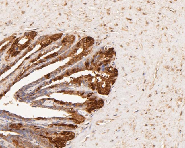 AKR1B1 Antibody in Immunohistochemistry (Paraffin) (IHC (P))