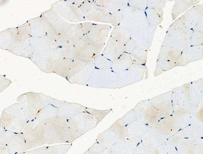 Phospho-EPS15 (Tyr849) Antibody in Immunohistochemistry (Paraffin) (IHC (P))