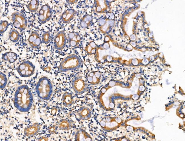 ITGB5 Antibody in Immunohistochemistry (Paraffin) (IHC (P))