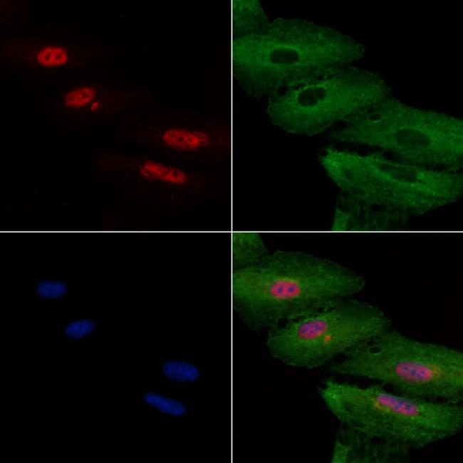 DKC1 Antibody in Immunocytochemistry (ICC/IF)