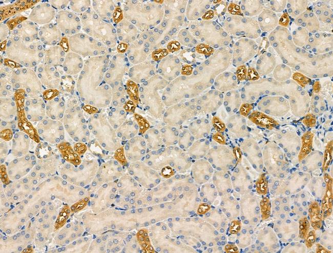 NAA15 Antibody in Immunohistochemistry (Paraffin) (IHC (P))