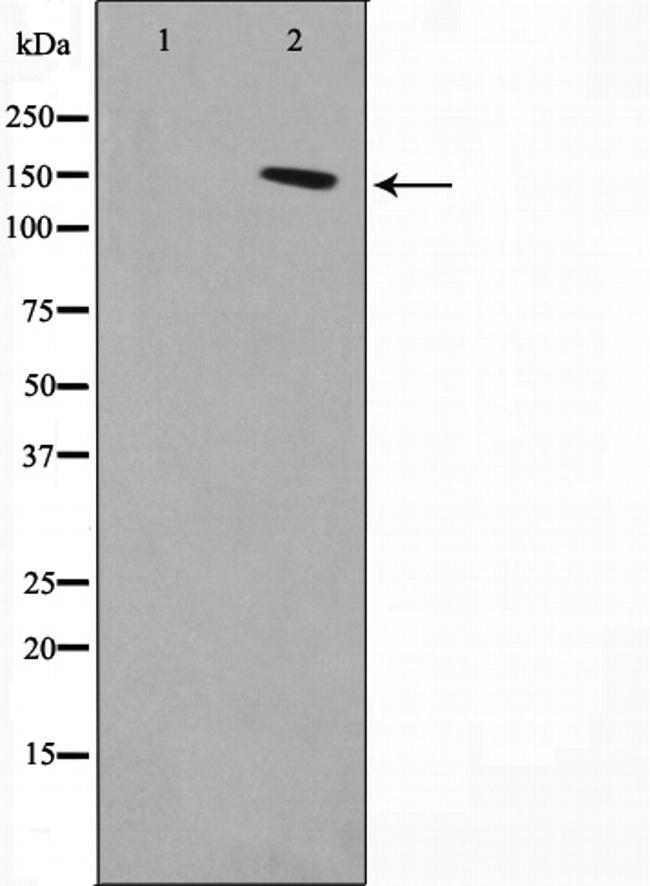 DGKD Antibody in Western Blot (WB)