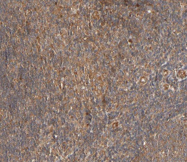 Phospho-PLCG2 (Tyr753) Antibody in Immunohistochemistry (Paraffin) (IHC (P))