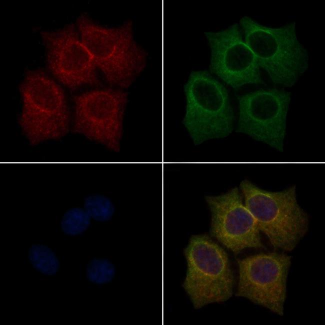 Phospho-LIMK1 (Thr508) Antibody in Immunocytochemistry (ICC/IF)