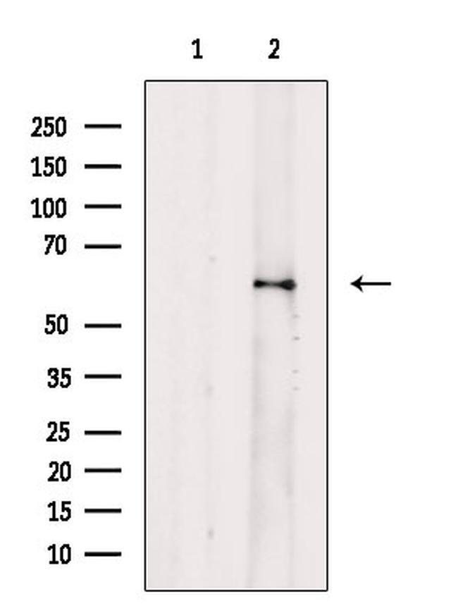 Phospho-CHK2 (Thr432) Antibody in Western Blot (WB)