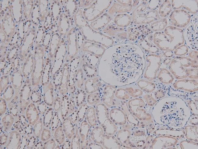 Phospho-c-Jun (Ser249) Antibody in Immunohistochemistry (Paraffin) (IHC (P))