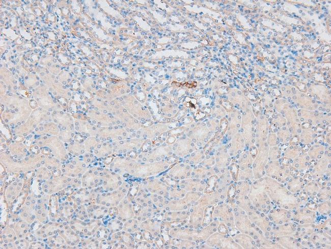 Phospho-eNOS (Ser1179) Antibody in Immunohistochemistry (Paraffin) (IHC (P))