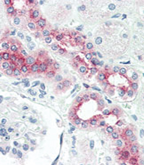 BMPR2 Antibody in Immunohistochemistry (Paraffin) (IHC (P))