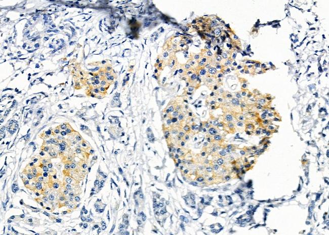 Phospho-eNOS (Ser114) Antibody in Immunohistochemistry (Paraffin) (IHC (P))