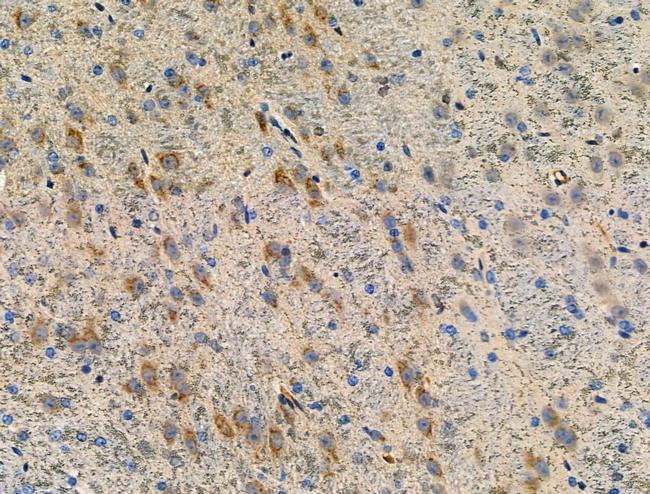 Phospho-LIMK1 (Ser323) Antibody in Immunohistochemistry (Paraffin) (IHC (P))