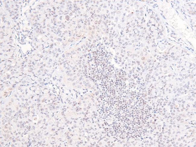 Phospho-PDGFRB (Tyr579, Tyr581) Antibody in Immunohistochemistry (Paraffin) (IHC (P))