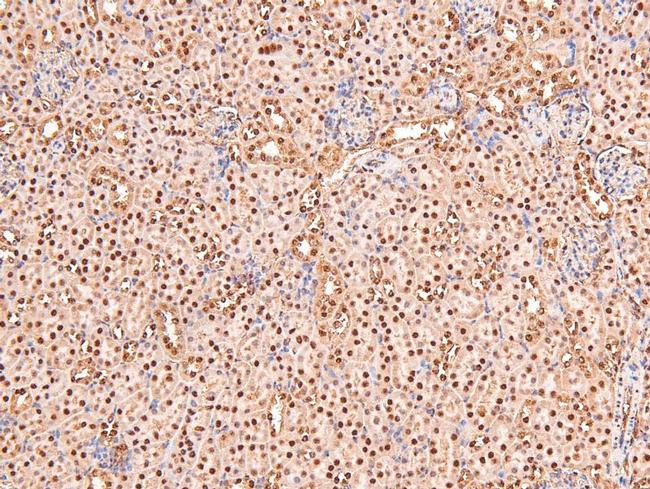 Phospho-BRCA1 (Ser1497) Antibody in Immunohistochemistry (Paraffin) (IHC (P))