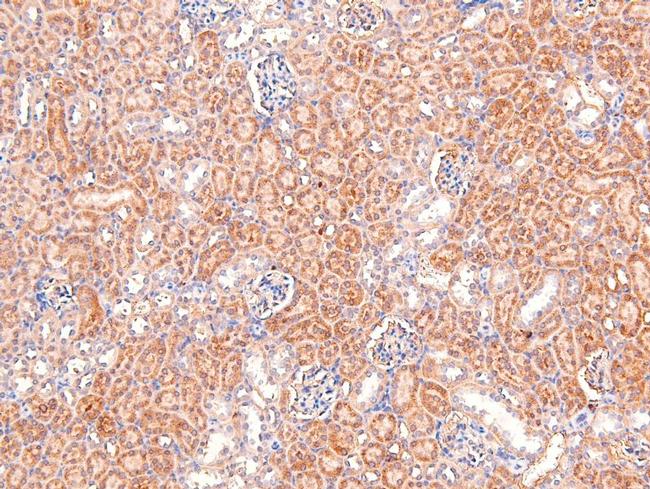 Phospho-delta Catenin (Tyr257) Antibody in Immunohistochemistry (Paraffin) (IHC (P))