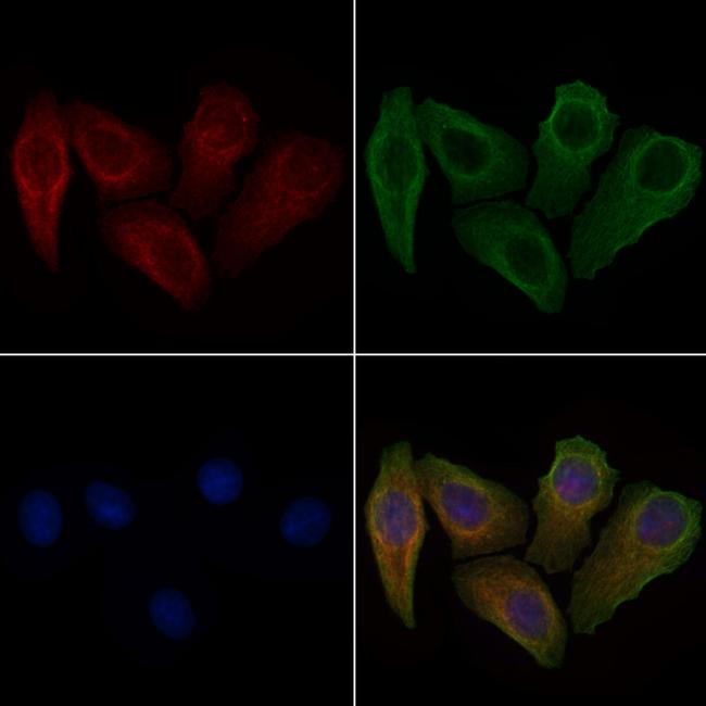 Phospho-Cyclin B1 (Ser133) Antibody in Immunocytochemistry (ICC/IF)