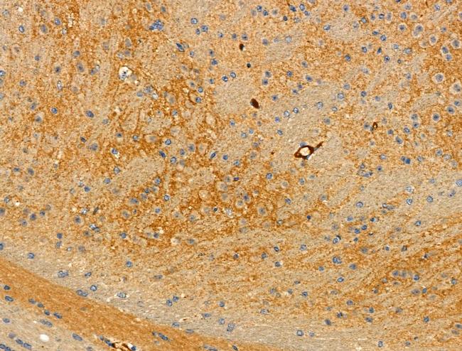 Phospho-RGS19 (Ser151) Antibody in Immunohistochemistry (Paraffin) (IHC (P))