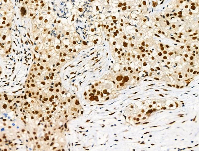 Phospho-LIMK1 (Ser310) Antibody in Immunohistochemistry (Paraffin) (IHC (P))