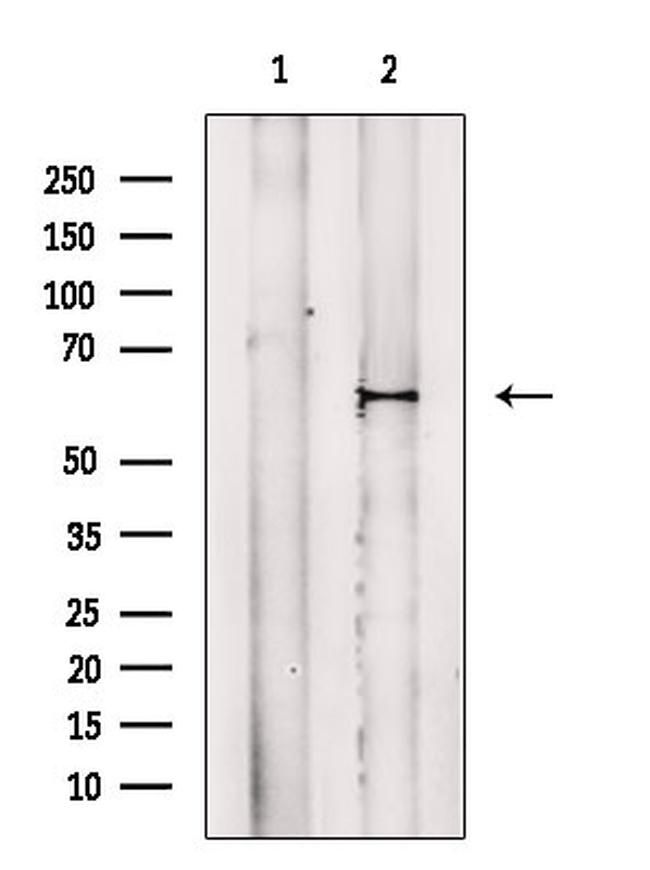 Phospho-MAP2 (Thr1616) Antibody in Western Blot (WB)