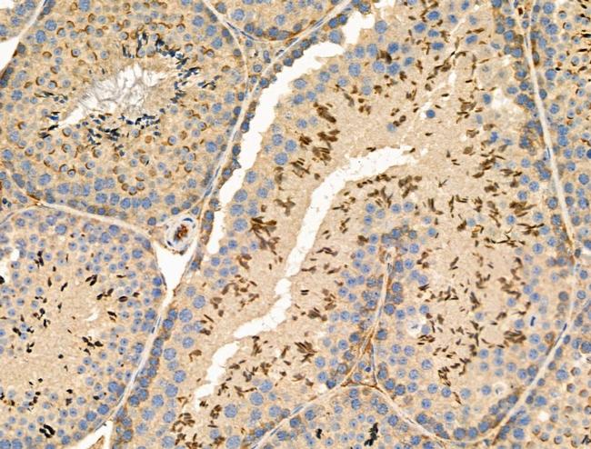 Phospho-NACA (Ser43) Antibody in Immunohistochemistry (Paraffin) (IHC (P))