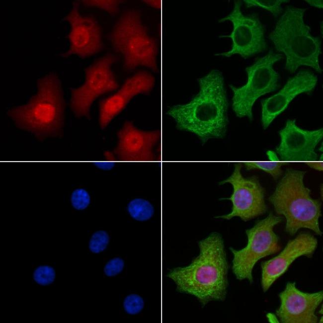 Phospho-PDX1 (Ser61) Antibody in Immunocytochemistry (ICC/IF)