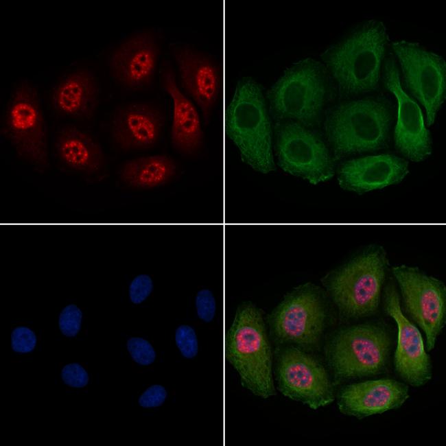 Phospho-PDX1 (Ser66) Antibody in Immunocytochemistry (ICC/IF)