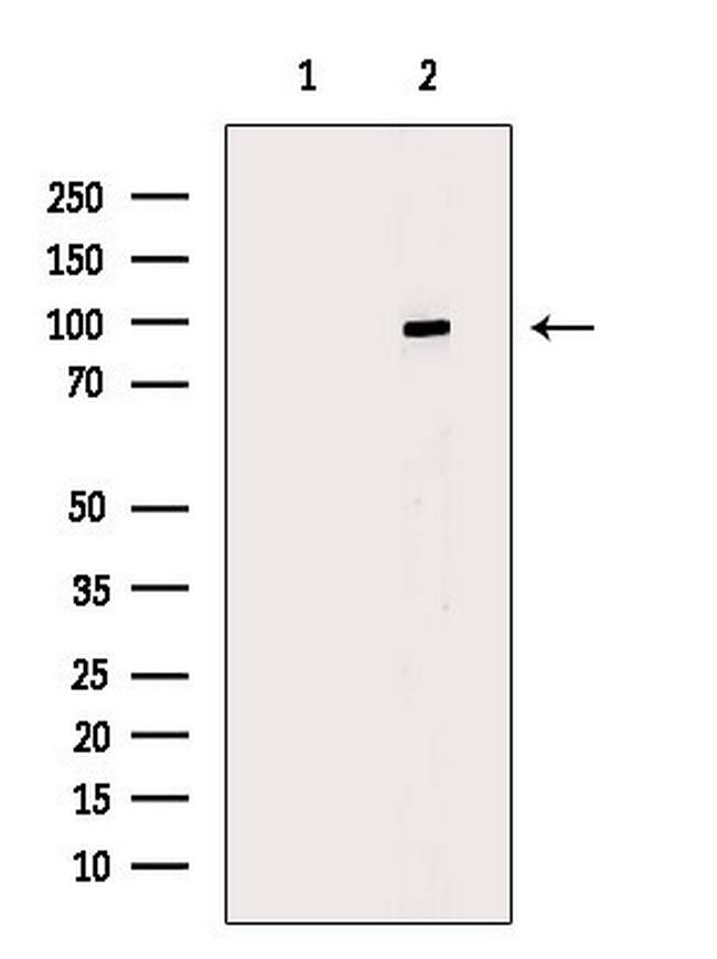 Phospho-Progesterone Receptor (Ser345) Antibody in Western Blot (WB)