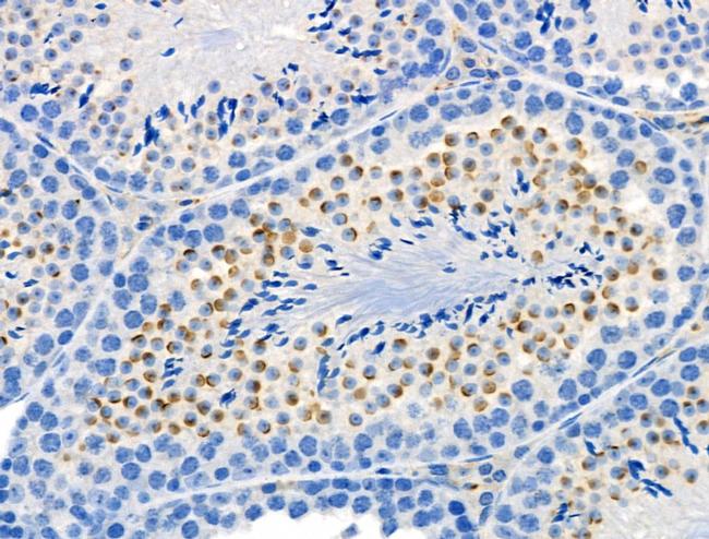 Phospho-Presenilin 1 (Ser353) Antibody in Immunohistochemistry (Paraffin) (IHC (P))