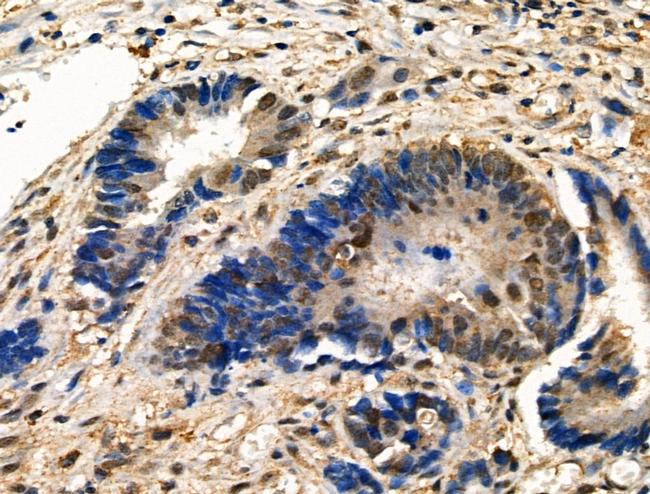 Phospho-RAD50 (Ser635) Antibody in Immunohistochemistry (Paraffin) (IHC (P))