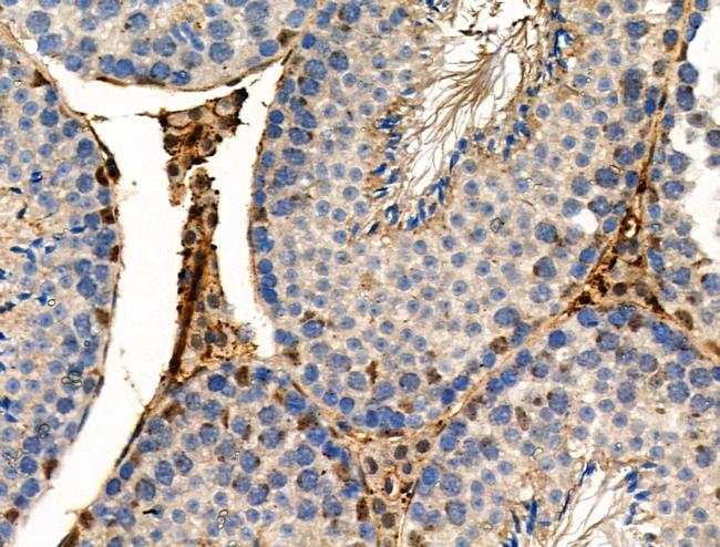 Phospho-TSC2 (Ser981) Antibody in Immunohistochemistry (Paraffin) (IHC (P))