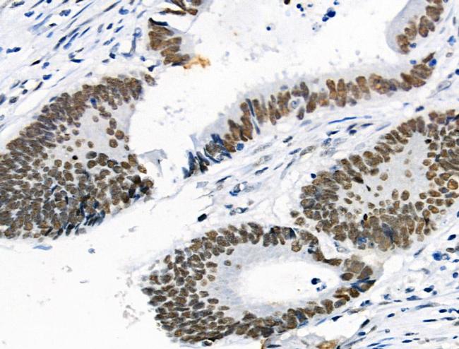 Phospho-Cyclin E (Ser399) Antibody in Immunohistochemistry (Paraffin) (IHC (P))