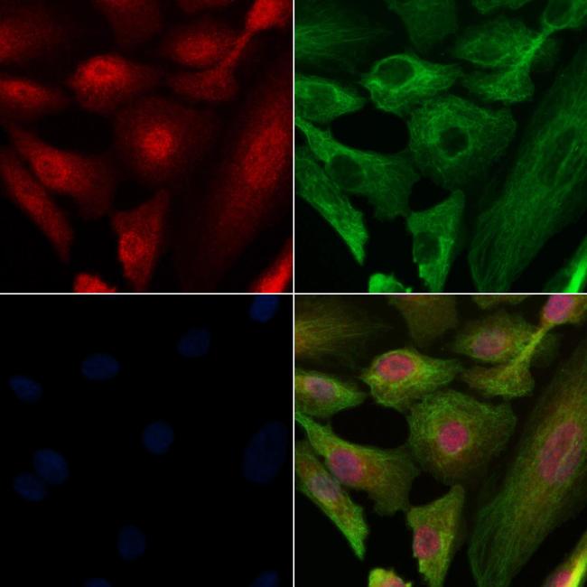 Phospho-PRK1/PRK2 (Thr774, Thr816) Antibody in Immunocytochemistry (ICC/IF)