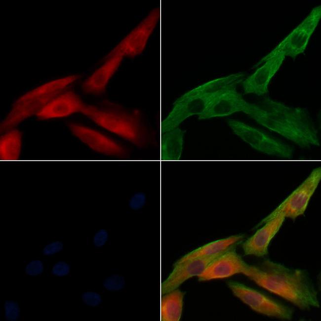 Phospho-Caspase 3 (Ser26) Antibody in Immunocytochemistry (ICC/IF)