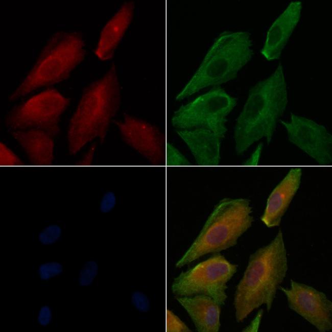 Phospho-E-cadherin (Ser844) Antibody in Immunocytochemistry (ICC/IF)