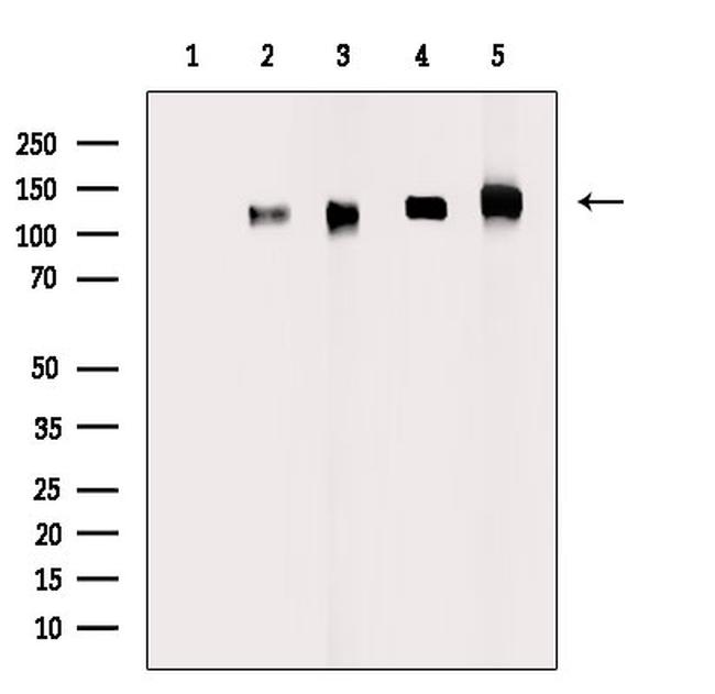 Phospho-EphA5 (Tyr650) Antibody in Western Blot (WB)