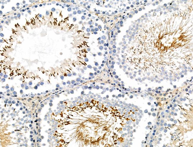 Phospho-MYPT1/MYPT2 (Ser668, Ser618) Antibody in Immunohistochemistry (Paraffin) (IHC (P))