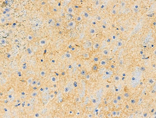 Phospho-AP2M1 (Thr156) Antibody in Immunohistochemistry (Paraffin) (IHC (P))