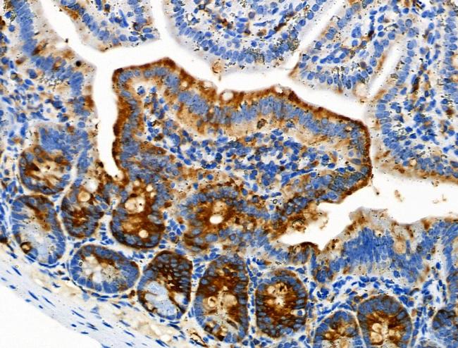 Phospho-ATP1A1 (Tyr260) Antibody in Immunohistochemistry (Paraffin) (IHC (P))